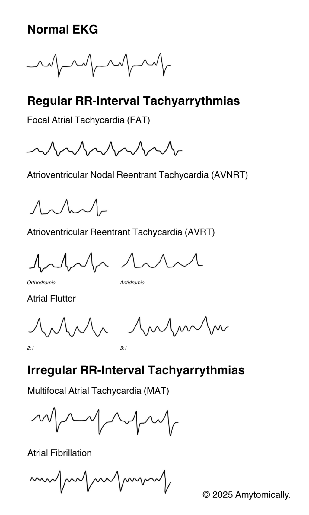 Supraventricular Tachyarrhythmias