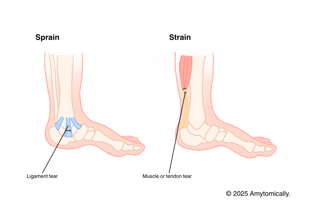 Sprains & Strains